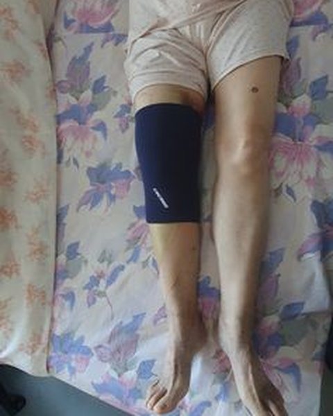 A customer wearing the Cocoon knee sleeve